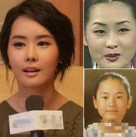 曝韩国女星整容变脸对比照：李多海尹恩惠变化惊人